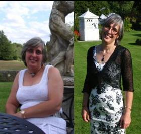 Sue before and after